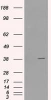 SORD / Sorbitol Dehydrogenase Antibody (clone OTI1D5)