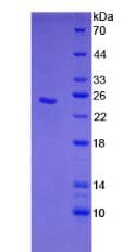Human CLEC4C / CD303 / BDCA-2 Protein (Recombinant His, N-Terminal)