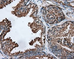 TUBA8 / Tubulin Alpha 8 Antibody (clone OTI2G6, Carrier-free)