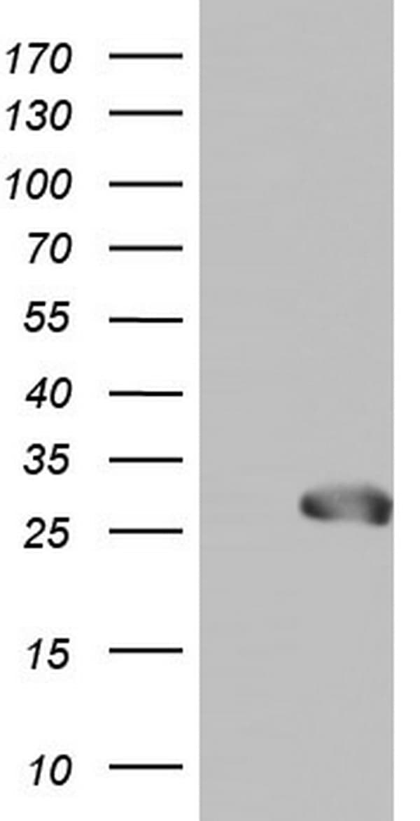 SPA17 / Sperm Protein 17 Antibody (clone OTI3E9)