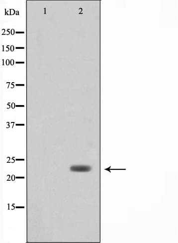 BAK1 / BAK Antibody