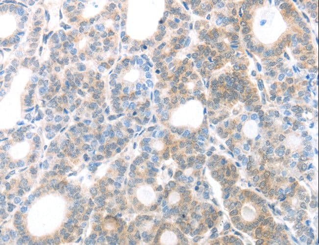 Polyclonal Rabbit anti-Human MAGED1 / NRAGE Antibody (IHC, WB)