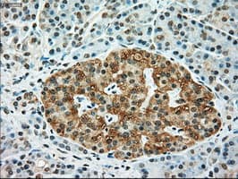 TYRO3 Antibody (clone OTI2D11)