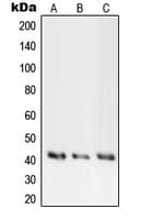 Polyclonal Rabbit anti-Human PRKACA + PRKACB + PRKACG Antibody (Internal, IHC, IF, WB)