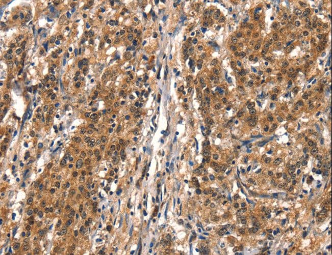 Polyclonal Rabbit anti-Human DDX4 / VASA Antibody (IHC)