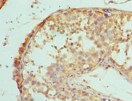 IHC-plus™ Polyclonal Rabbit anti-Human MAP2K5 / MEK5 Antibody (aa1-190, IHC)