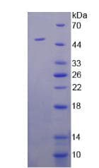 Human ASS1 / ASS Protein (Recombinant 6His, N-terminus)
