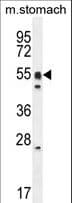 Polyclonal Rabbit anti-Human DMRTA1 Antibody (aa322-350, WB)