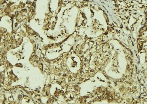 RBBP9 Antibody
