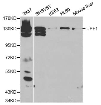 RENT1 / UPF1 Antibody