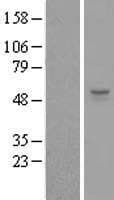 ZSWIM1 Protein (Over-Expression Lysate Myc-DDK (Flag))