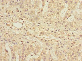 PSMD13 Antibody