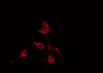 Polyclonal Rabbit anti-Human RPS23 / Ribosomal Protein S23 Antibody (IF, WB)
