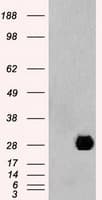 Monoclonal Mouse anti-Human NEUROG1 / NGN1 / Neurogenin 1 Antibody (clone OTI5A10, IHC, WB)