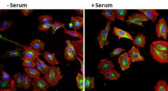 EGF Antibody (clone 9A1)