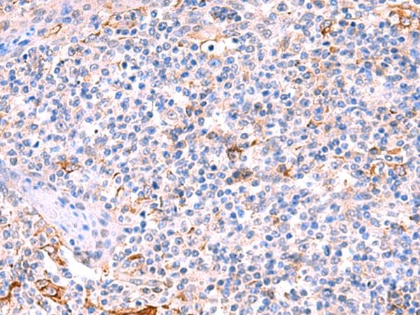 Polyclonal Rabbit anti-Human FUCA2 Antibody (IHC, WB)