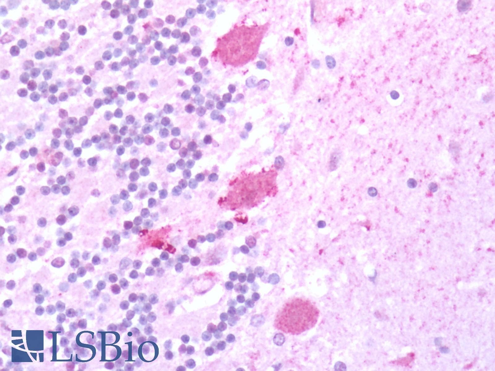 PathPlus™ Polyclonal Rabbit anti-Human HTR7 / 5HT7 Receptor Antibody (C-Terminus, IHC)