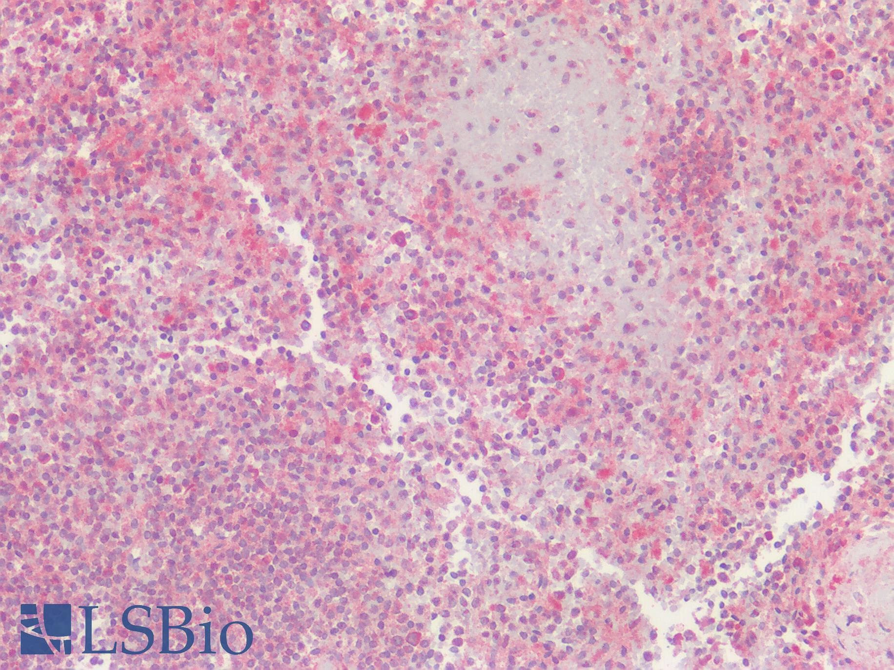 IHC-plus™ GPRC5D Antibody (Cytoplasmic Domain)