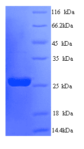 Rat SOCS3 Protein (Recombinant His)