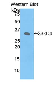 KIR2DS4 Antibody (aa22-302, Cy3)