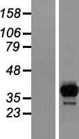 HACL1 Protein (Over-Expression Lysate Myc-DDK (Flag))