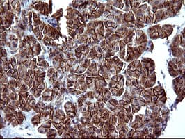 EPCAM Antibody (clone OTI1H9)