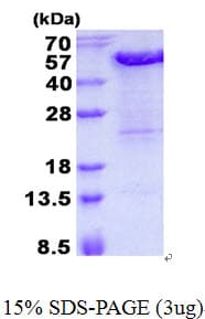 Human KIN17 / KIN Protein (Recombinant His)