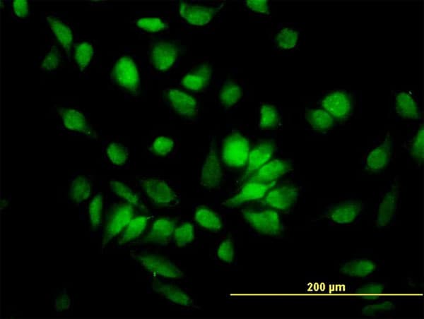 IHC-plus™ Monoclonal Mouse anti-Human PHAP1 / ANP32A Antibody (clone 2G11-4A5, IHC, IF, WB)