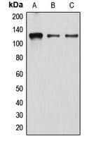 Polyclonal Rabbit anti-Human DRPLA / Atrophin-1 Antibody (N-Terminus, WB)