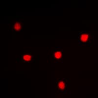 IHC-plus™ Polyclonal Rabbit anti-Human UTP14A Antibody (Internal, IHC, IF, WB)