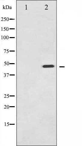 SYT1 / Synaptotagmin Antibody (phospho-Ser309)