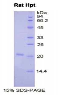 Rat HP / Haptoglobin Protein (Recombinant His)