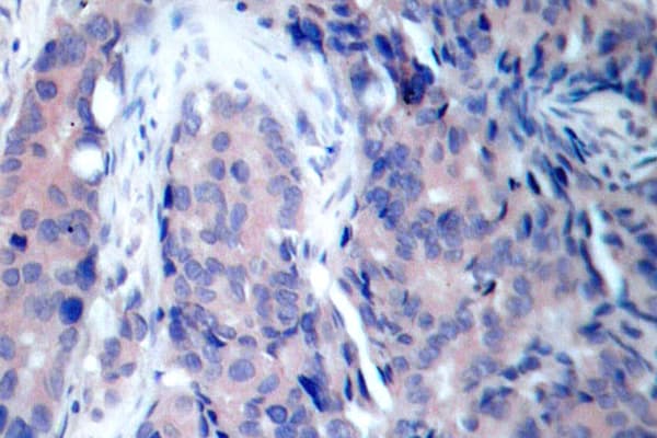 Polyclonal Rabbit anti-Human MAP2K4 / MKK4 Antibody (Val255, IHC)