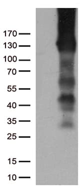 PECAM-1 / CD31 Antibody (clone UMAB29)