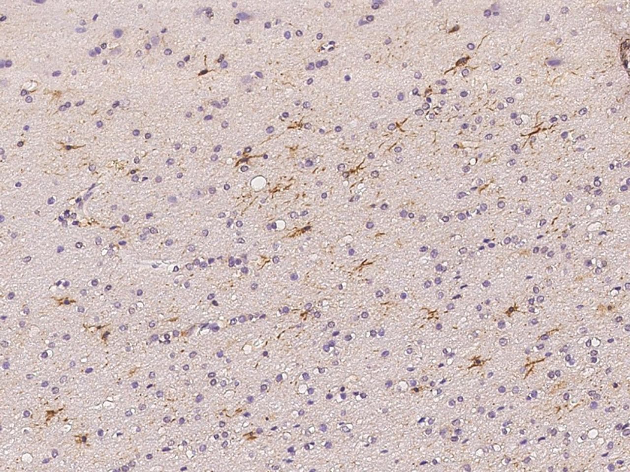 TRIM64C Antibody