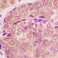 Polyclonal Rabbit anti-Human STAT6 Antibody (Internal, IHC, WB)