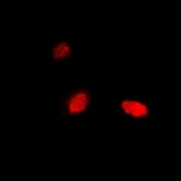 NUDT2 Antibody