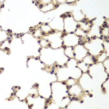 GSS / Glutathione Synthetase Antibody