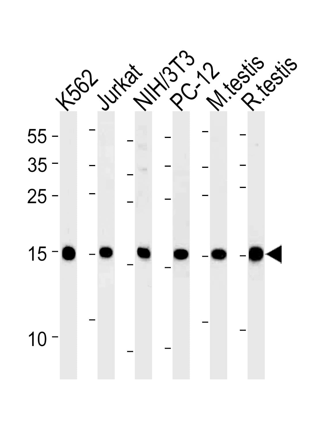 UBE2L3 / UBCH7 Antibody (aa106-135)