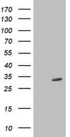 SIRT5 / Sirtuin 5 Antibody (clone OTI2C4)