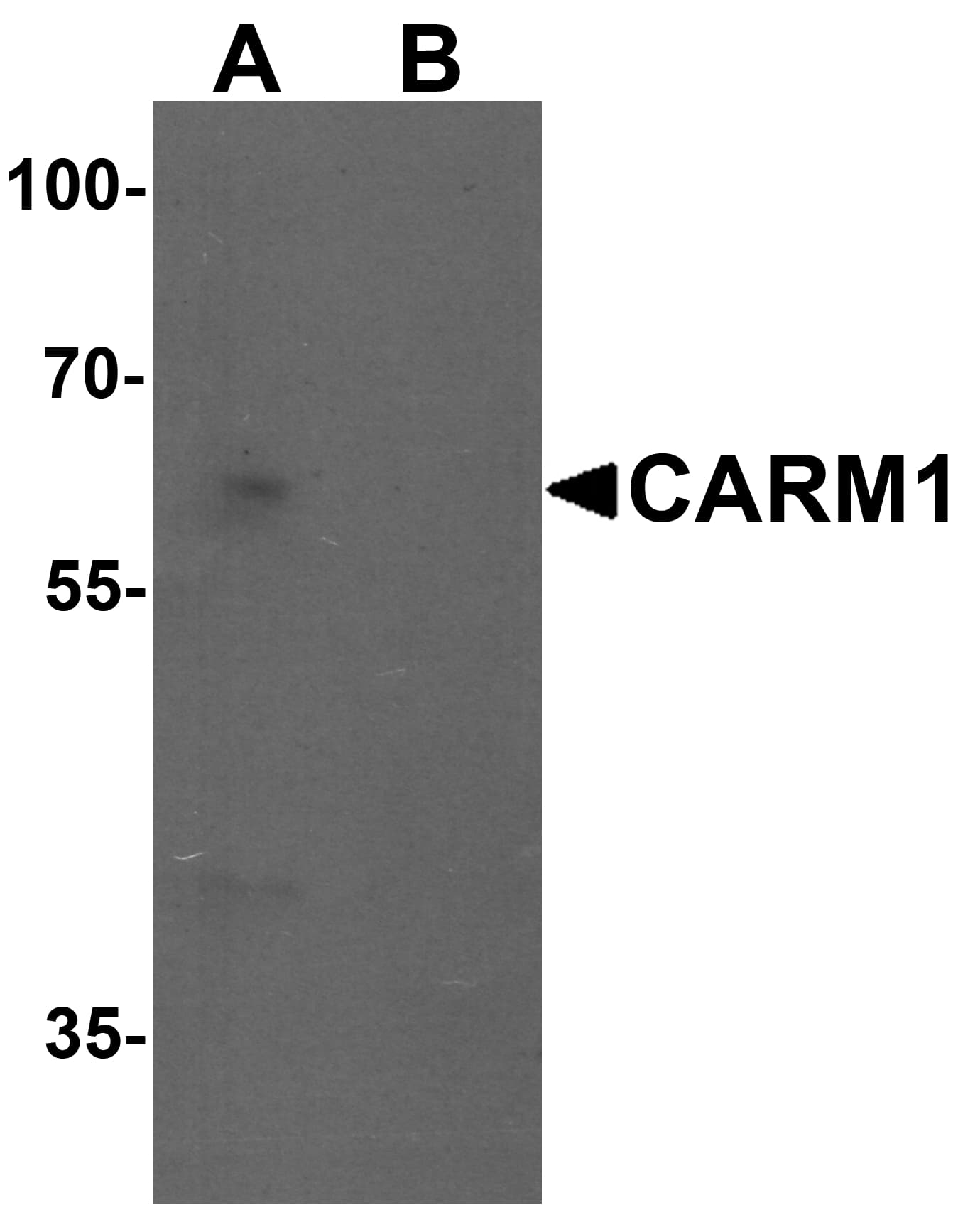 IHC-plus™ PRMT4 / CARM1 Antibody