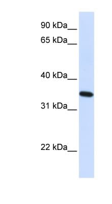RTN1 / Reticulon 1 Antibody (aa36-85)