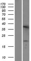 TMEM42 Protein (Over-Expression Lysate Myc-DDK (Flag))