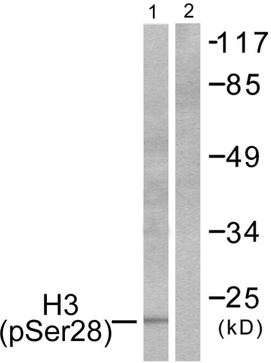 Histone H3 Antibody (phospho-Ser28)