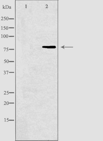 Polyclonal Rabbit anti-Human DVL3 / Dishevelled 3 Antibody (IHC, IF, WB)