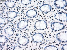 CHEK2 / CHK2 Antibody (clone OTI2H5)