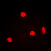 RNF40 / STARING Antibody