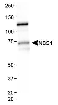 NBN / Nibrin Antibody (aa400-650, clone 7E4A2)