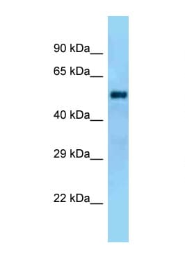 Polyclonal Rabbit anti-Rat GAL3ST4 Antibody (aa130-179, WB)