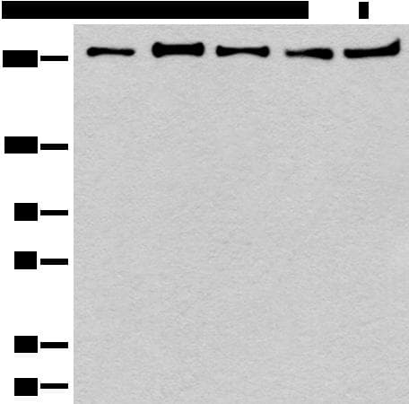 PRPF8 Antibody